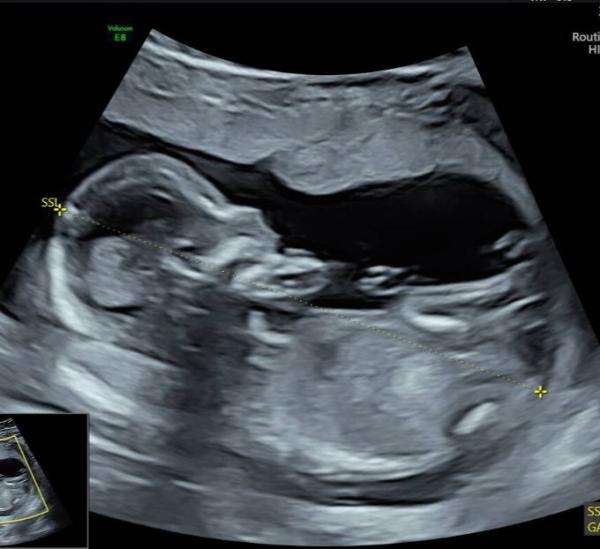 Bild zu Geschlecht - Forum für September - Mamis