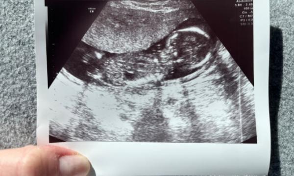 Bild zu So froh.. - Forum für September - Mamis