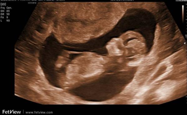 Bild zu Erfahrungen als Jungs-Mama? - Forum für September - Mamis