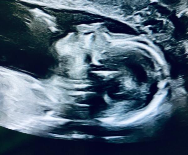 Bild zu Murmelmittwoch - Forum für September - Mamis