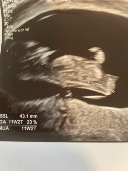Bild zu Nub Theorie 💗💙 - Forum für September - Mamis