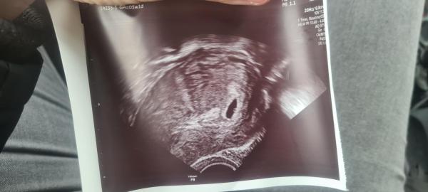 Bild zu Ich habe heute....ein Foto für euch! - Forum für September - Mamis