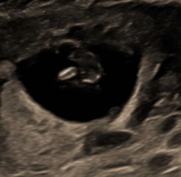 Bild zu Junge oder Mädchen was meint ihr? 💙🩷 - Forum für September - Mamis