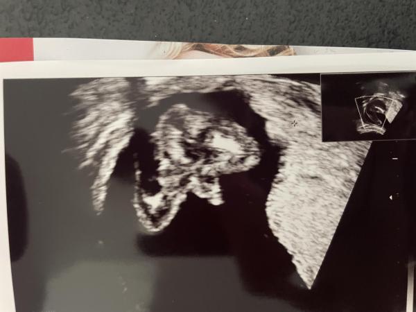Bild zu Mädchen oder Junge - Forum für September - Mamis