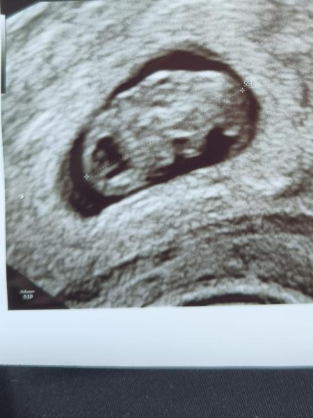 Bild zu 1. Frauenarzttermin 7+5 - Forum für September - Mamis