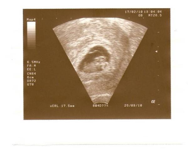 Bild zu Happy zurück vom FA mit Bild - Forum für Oktober - Mamis