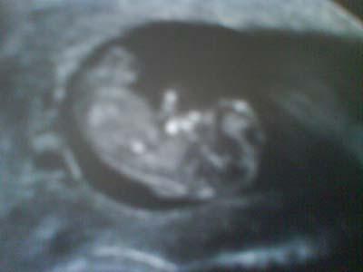 Bild zu Bericht vom FA mit Foto ;-) - Forum für Oktober - Mamis