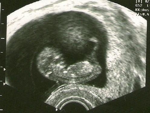 Bild zu Wollte mal das aktuelle Bild von gestern zeigen ^^ - Forum für Oktober - Mamis