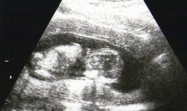 Bild zu VU - Forum für Oktober - Mamis