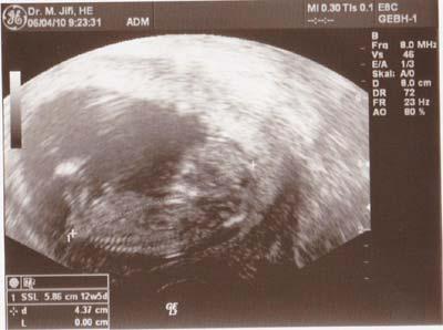 Bild zu Das US Bild von Dienstag 6.4 - Forum für Oktober - Mamis