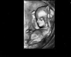 Bild zu So, jetzt hab ich mal ein Foto von unserem Wunder - Forum für Oktober - Mamis