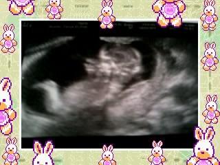 Bild zu Heute wieder Kontrolle und supersüßes BIld :-) - Forum für Oktober - Mamis