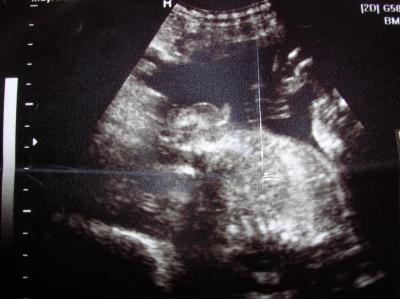 Bild zu Ist das wirklich eindeutig ein Junge - Forum für Oktober - Mamis