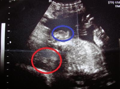 Bild zu sind da wirklich alle zwei Geschlechter vorhanden. - Forum für Oktober - Mamis