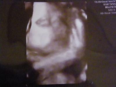 Bild zu VU - 3. grosser US - wie schwer sind eure babys? + 4-D Bild ;-) - Forum für Oktober - Mamis