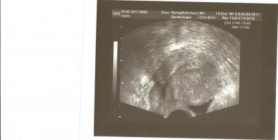 Bild zu ich war heute beim FA und mein erstes Ultraschallbild - Forum für Oktober - Mamis