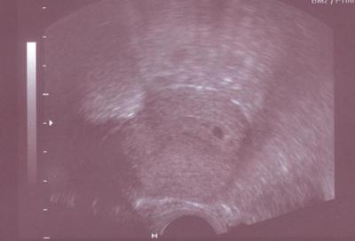 Bild zu Zurück vom FA - erste Fotos - Forum für Oktober - Mamis