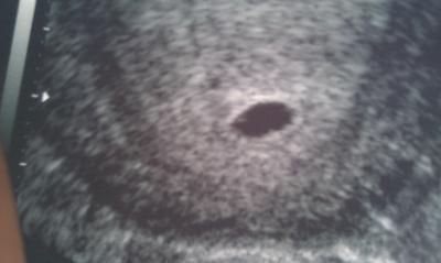 Bild zu öööhm meine schwiegi meint das sind 2 ??? - Forum für Oktober - Mamis