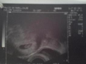 Bild zu Neues Foto vom Krümel... - Forum für Oktober - Mamis