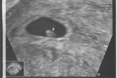 Bild zu Das Foto... - Forum für Oktober - Mamis