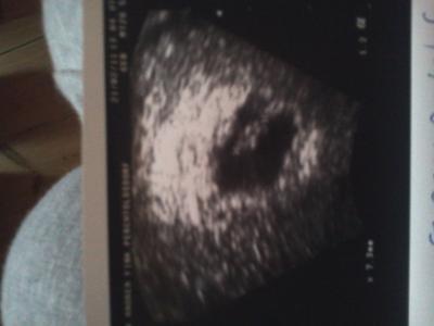 Bild zu zurück vom fa  + Foto. - Forum für Oktober - Mamis