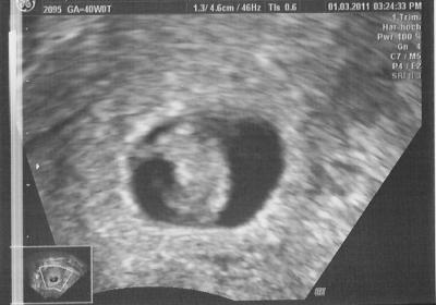 Bild zu Das Bildchen.... - Forum für Oktober - Mamis