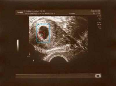 Bild zu das erste Bild - Forum für Oktober - Mamis