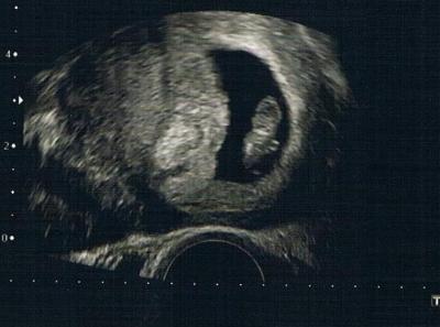 Bild zu Neues Bildchen! - Forum für Oktober - Mamis