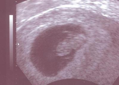 Bild zu Zurück vom FA - neues Foto - Forum für Oktober - Mamis