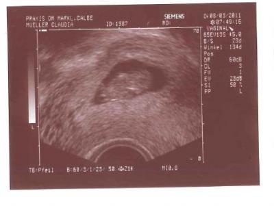 Bild zu zurück von der 1. VU - Forum für Oktober - Mamis