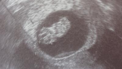 Bild zu Ihr Süßen...bin wieder da - Forum für Oktober - Mamis