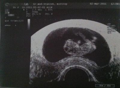 Bild zu brauche dringend rat =( bitte um hilfe =( - Forum für Oktober - Mamis
