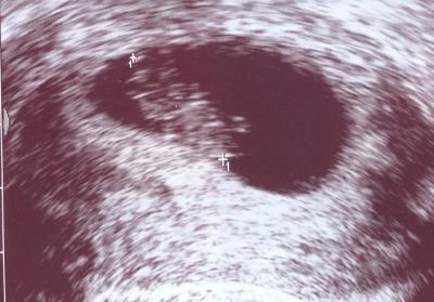 Bild zu die neusten Bilder - Forum für Oktober - Mamis