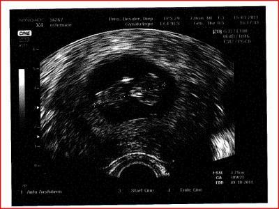 Bild zu FA Termin und jetzt noch das Foto - Forum für Oktober - Mamis