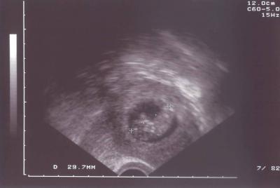 Bild zu Bild nachgereicht von 10+2 - Forum für Oktober - Mamis