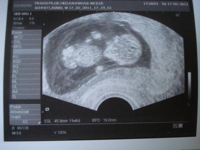 Bild zu Bild nachreichen: - Forum für Oktober - Mamis