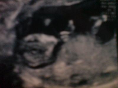 Bild zu Und noch eine gute Nachricht an diesem Tag - Forum für Oktober - Mamis