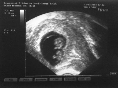 Bild zu Wieder da von der VU! - Forum für Oktober - Mamis