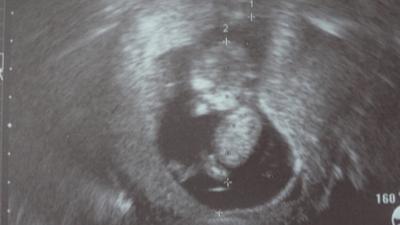 Bild zu Möchte Euch jemanden vorstellen... - Forum für Oktober - Mamis