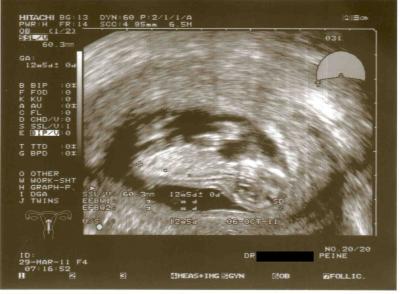 Bild zu Zurück vom FA :-) - Forum für Oktober - Mamis