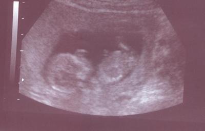Bild zu Heute war Baby-TV-Tag - Forum für Oktober - Mamis