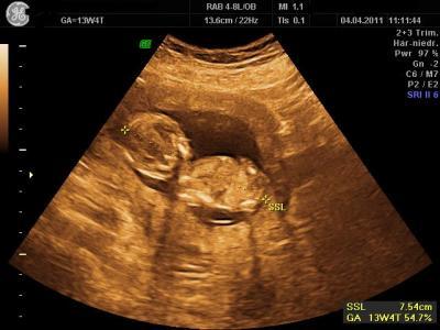 Bild zu Bin auch zurück vom FA + eventuelles Outing - Forum für Oktober - Mamis