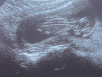 Bild zu Bin wieder da.... - Forum für Oktober - Mamis