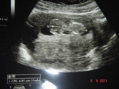Bild zu Zweiter FA-Besuch - juhui! - Forum für Oktober - Mamis