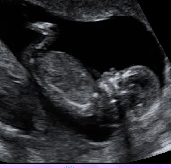 Bild zu Foto - Forum für Oktober - Mamis