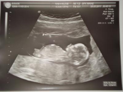 Bild zu 16.SSW!!!! - Forum für Oktober - Mamis