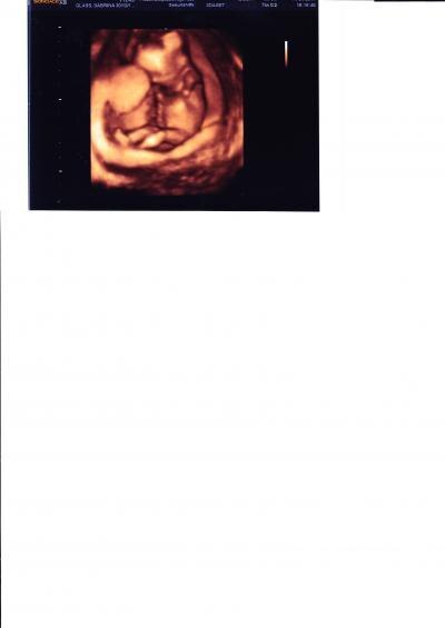 Bild zu FA-Termin gestern - Forum für Oktober - Mamis