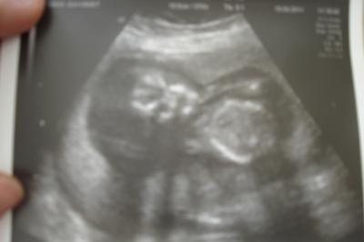 Bild zu und noch 3 Bildchen - Forum für Oktober - Mamis