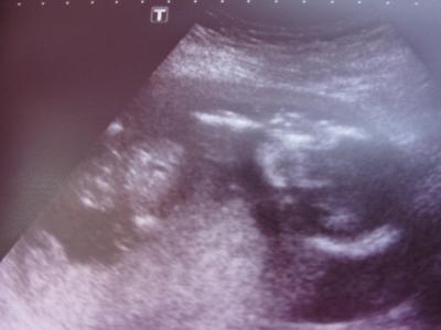 Bild zu Guten Morgen ihr Süßen... - Forum für Oktober - Mamis