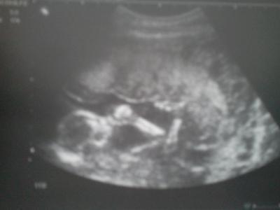 Bild zu Meldung von mir.... - Forum für Oktober - Mamis